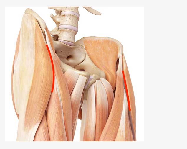 Hüftprothese durch den vorderer Zugang
